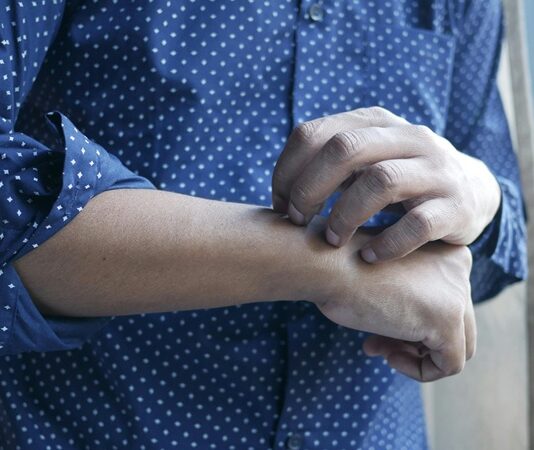 Modern yaşam koşulları ve çevresel faktörlerin etkisiyle giderek daha fazla kişide görülen alerji, bağışıklık sisteminin zararsız maddelere karşı aşırı tepki göstermesiyle ortaya çıkan bir durumdur. Polen, toz, bazı yiyecekler, hayvan tüyleri veya ilaçlar gibi normalde tehdit oluşturmayan maddelere karşı vücudun savunma mekanizmasının abartılı bir yanıt vermesi sonucu çeşitli semptomlar gelişebilir. Alerjik reaksiyonlar hafif kaşıntı ve burun akıntısından anafilaksi gibi yaşamı tehdit eden ciddi tablolara kadar değişiklik gösterebilir. Bu nedenle alerji, hafife alınmaması gereken ve iyi yönetilmesi gereken bir bağışıklık sorunudur. Konulu bir haber görseli.