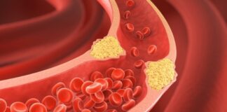 Kolesterol, vücutta bulunan ve vücudun birçok önemli işlevini sürdürebilmesi için gerekli olan bir yağ molekülüdür. Ancak, kolesterolün türü ve seviyeleri, sağlığımız üzerinde büyük bir etkiye sahiptir. Kolesterol seviyelerini değerlendiren önemli terimler arasında HDL ve LDL kolesterol yer alır. Bu iki terim, kalp sağlığı açısından kritik rol oynayan ve doktorların hastalarının kolesterol seviyelerini değerlendirmede kullandığı başlıca göstergelerdir. Bu yazıda, HDL ve LDL kolesterolün ne anlama geldiğini, bunların vücut üzerindeki etkilerini ve nasıl yönetilebileceğini inceleyeceğiz. Konulu bir haber görseli.