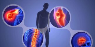 İnflamasyon, vücudun bağışıklık sistemi tarafından, enfeksiyon, yaralanma ya da zararlı uyarıcılara karşı bir savunma mekanizması olarak başlatılan doğal bir reaksiyondur. Bu süreç, vücudun iyileşme ve korunma çabalarına hizmet eder. Ancak, inflamasyon kontrolsüz bir şekilde devam ettiğinde ya da kronikleştiğinde, sağlığımıza ciddi zararlar verebilir. Bu yazıda, inflamasyonun ne olduğunu, vücuttaki rolünü ve potansiyel tehlikelerini ele alacağız. Konulu bir haber görseli.