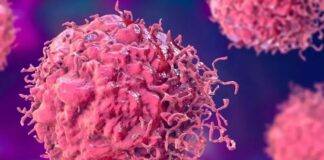 Kanser, vücudun kontrolsüz bir şekilde büyüyen ve çoğalan hücrelerle ilgili bir hastalık grubudur. Herkesin hayatında bir noktada duyduğu ve korktuğu bu hastalık, aslında normal hücre büyüme ve bölünme süreçlerinde meydana gelen bozukluklardan kaynaklanır. Kanser hücreleri, vücudun genetik yapısında oluşan bir dizi değişiklik sonucunda ortaya çıkar. Kanser hücrelerinin nasıl oluştuğu, nasıl yayılma gösterdiği ve tedavi edilebilirliği konuları, modern tıbbın en çok araştırılan alanlarından biridir. Bu yazıda, kanser hücrelerinin oluşum sürecini ve vücutta nasıl yayılmaya başladığını detaylı bir şekilde inceleyeceğiz. Konulu bir haber görseli.