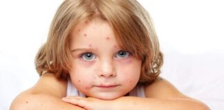 Son yıllarda dünya genelinde kızamık salgınlarında dikkat çeken bir artış gözlemleniyor. Bir zamanlar neredeyse tamamen kontrol altına alınmış olan bu bulaşıcı hastalık, özellikle gelişmiş ülkelerde dahi yeniden gündeme gelmiş durumda. Sağlık otoriteleri, aşılamaya olan güvensizlik, sosyal medya dezenformasyonu, göç hareketleri ve sağlık hizmetlerine erişimdeki eşitsizlikler gibi çeşitli faktörlerin kızamığın tekrar ortaya çıkmasında etkili olduğunu vurguluyor. Peki, bu hastalık neden geri döndü ve halk sağlığı açısından ne gibi riskler oluşturuyor? Konulu bir haber görseli.