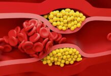 Kalp ve damar sağlığını doğrudan etkileyen konular arasında ilk sıralarda yer alan kolesterol, çoğu zaman kötü bir şeymiş gibi algılansa da aslında vücudun temel yapı taşlarından biridir. Hücre zarlarının yapısında bulunan, hormon üretiminde görev alan ve D vitamini sentezine yardımcı olan bu yağ benzeri madde, yalnızca gıdalarla alınmaz; karaciğer tarafından da üretilir. Ancak vücutta belli seviyelerin üzerine çıktığında ciddi sağlık problemlerine yol açabilir. Bu nedenle kolesterolün ne olduğu, neden yükseldiği ve hangi değerlerin tehlikeli kabul edildiği, toplum sağlığı açısından hayati bir önem taşır. Konulu bir haber görseli.