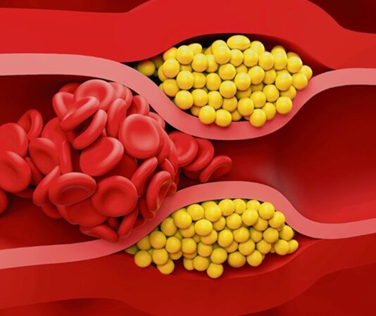 Kalp ve damar sağlığını doğrudan etkileyen konular arasında ilk sıralarda yer alan kolesterol, çoğu zaman kötü bir şeymiş gibi algılansa da aslında vücudun temel yapı taşlarından biridir. Hücre zarlarının yapısında bulunan, hormon üretiminde görev alan ve D vitamini sentezine yardımcı olan bu yağ benzeri madde, yalnızca gıdalarla alınmaz; karaciğer tarafından da üretilir. Ancak vücutta belli seviyelerin üzerine çıktığında ciddi sağlık problemlerine yol açabilir. Bu nedenle kolesterolün ne olduğu, neden yükseldiği ve hangi değerlerin tehlikeli kabul edildiği, toplum sağlığı açısından hayati bir önem taşır. Konulu bir haber görseli.