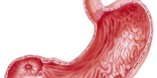 Ülser Nedir Stresle Gerçekten Bağlantısı Var Mı Ülser, mide ya da on iki parmak bağırsağında meydana gelen, genellikle ağrılı, iltihaplı yaralardır. Sindirim sistemi üzerinde önemli etkiler yaratabilen bu rahatsızlık, özellikle yemek sonrası mide asidinin etkisiyle artan ağrılarla kendini gösterir. Ülserin başlıca nedeni, mide asidinin aşırı üretimi ve bu asidin, sindirim organlarının koruyucu yüzeyine zarar vermesidir. Ancak son yıllarda yapılan araştırmalar, stresin de ülserin gelişmesinde önemli bir faktör olabileceğini göstermektedir. Bu haberimizde, ülserin ne olduğunu, nasıl geliştiğini ve stres ile olan bağlantısını inceleyeceğiz. Konulu bir haber detayı.